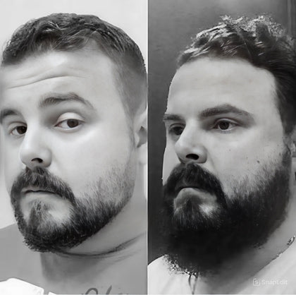 Imagem de antes e depois